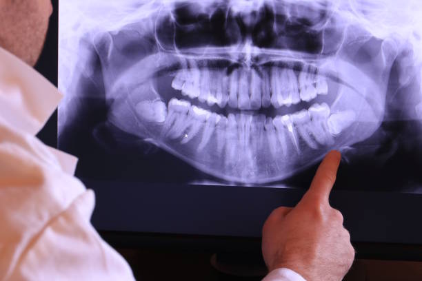 Best Emergency Care for Gum Disease in Cherryvale, KS