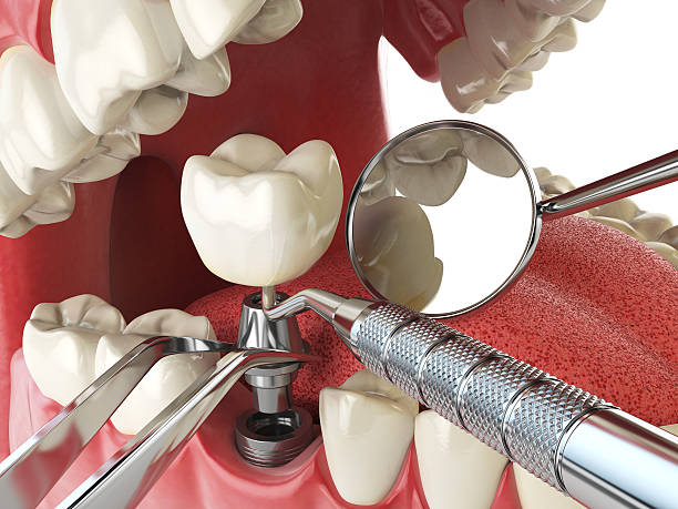 Best Emergency Treatment for Jaw Pain or Injury in Cherryvale, KS